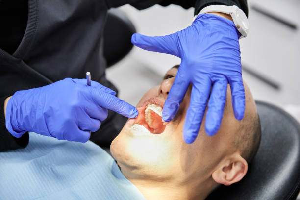 Best Emergency Tooth Extraction in Dayton, IN